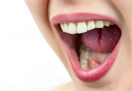舌苔厚白是什么原因引起的怎么解决