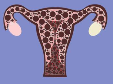 卵巢早衰的现象有哪些，这些症状有了表面你出现了卵巢早衰
