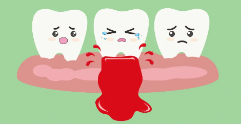 牙龈出血是怎么回事-牙龈出血是怎么回事生不注重