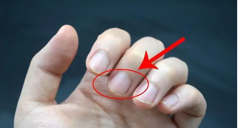 指甲有竖纹是身体的什么信号-指甲有竖纹是身体的什么信号水果类樱