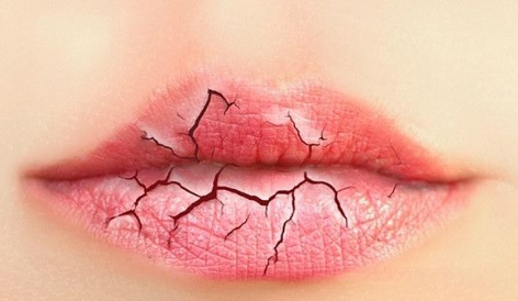 口干舌燥是怎么回事?口干舌燥是咋回事？该症状也不容忽视