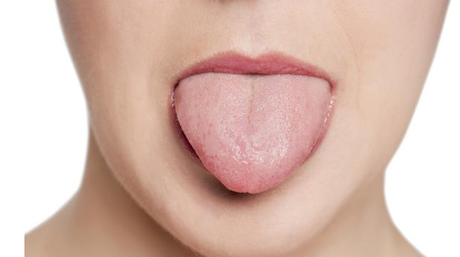 舌苔厚白最快消除方法