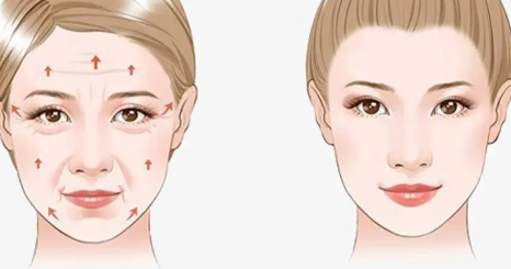 面部去皱方法,面部除皱常用方法有哪些?面部除皱这四种方法常用
