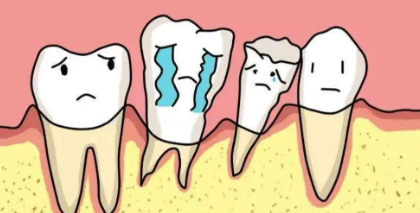 牙齿松动有什么办法恢复-牙齿松动有什么办法恢复关于的全
