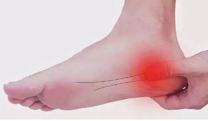 脚后跟疼是什么原因引起的怎么治，缓解足跟痛的方法有哪些