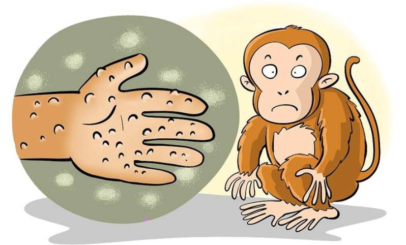 猴痘是什么症状，患上猴痘疾病有哪些症状