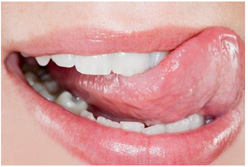 舌头上溃疡怎么治，舌尖溃疡一般几天能好